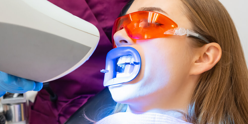 Teeth Whitening London