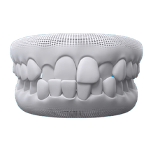 Crossbite