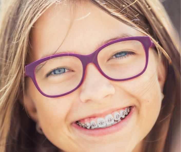 Dental braces treatment at MEK Dental in London